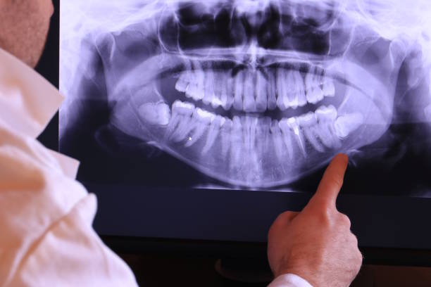 Best Emergency Treatment for Dental Infections or Abscesses in Holly Hill, FL